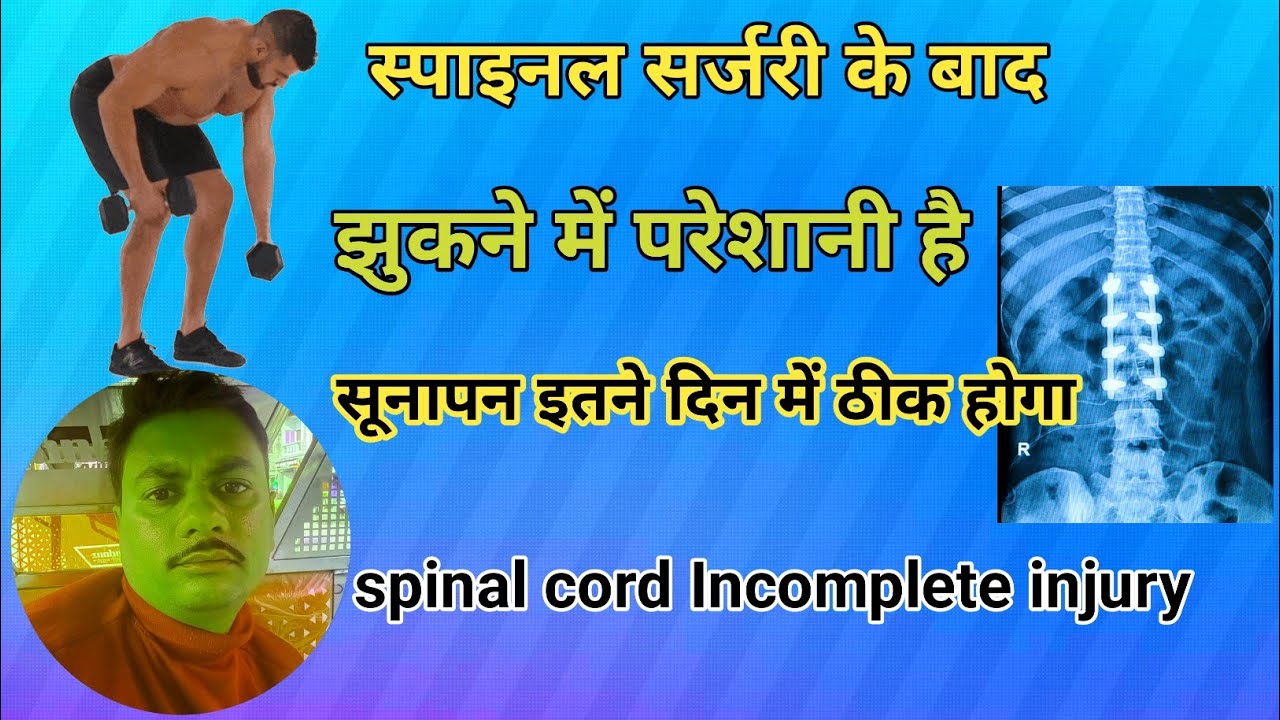 spine-surgery-k-kitne-din-bad-jhuk-skte-hai-youtube