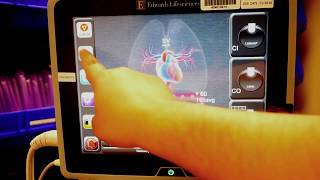 How to set up the Hemosphere-Edward's Lifescience Cardiac Output Monitor by MHST Educators 13,538 views 4 years ago 9 minutes, 35 seconds