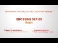 Grossing Brain Pathology Specimens | Department of Pathology and Laboratory Medicine