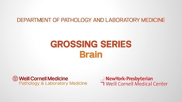 Grossing Brain Pathology Specimens | Department of Pathology and Laboratory Medicine