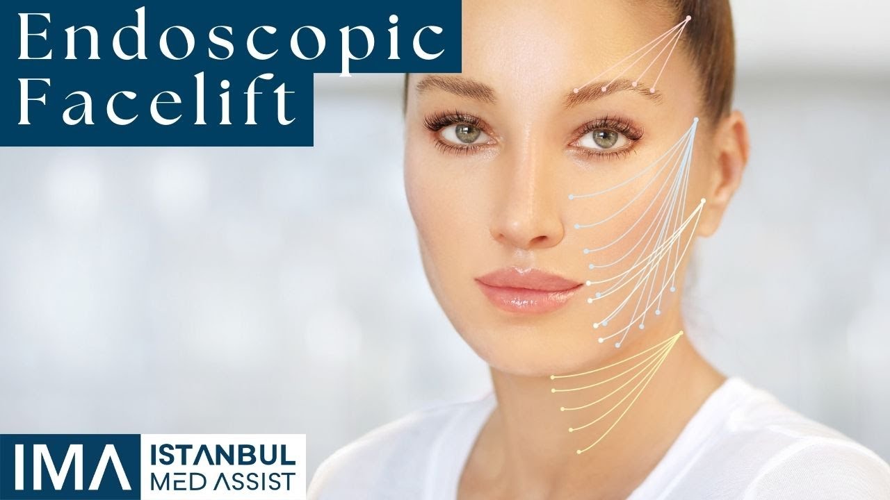 Endoscopic Facelift Istanbul Med Assist YouTube