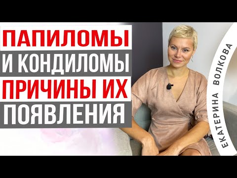 ВПЧ! Что нужно знать о папилломах и кондиломах. Как можно заразиться. Врач Екатерина Волкова.