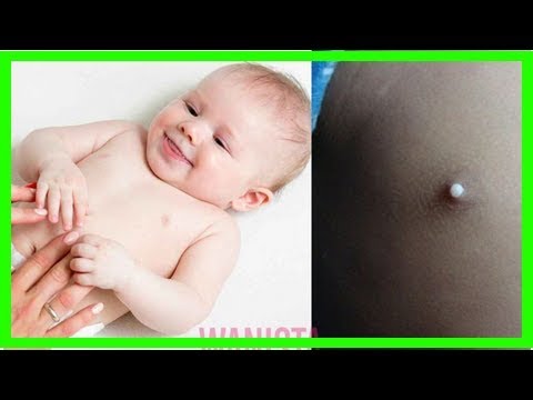 “Mak-Mak” Jangan Picit Puting Payudara Bayi Baru Lahir, Bahaya!
