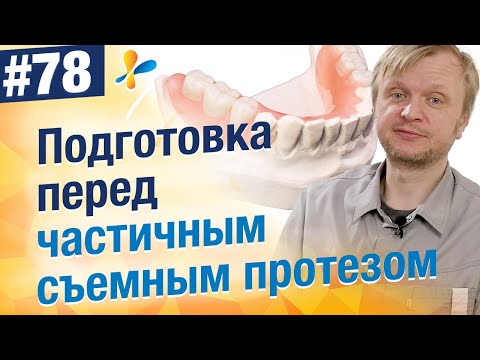 Видео: Как справиться с частичными протезами: 11 шагов (с иллюстрациями)