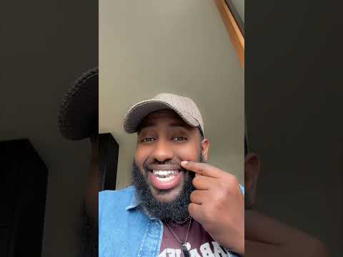 Dagaalka Toos Ah Ayaa Bilaawday Shaadiyo Sharaf