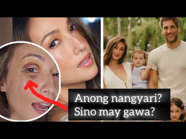 SOLENN HEUSSAFF, NAGKA-BLACK EYE?! TOTOO NGA BANG SI NICO ANG MAY GAWA?" | Trendvibes Entertainment - YouTube