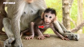 Alika very thin maybe her mum not feed enoug milk