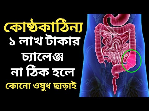 কোষ্ঠকাঠিন্য ঠিক হবে - ১ লাখ টাকার চ্যালেঞ্জ 🔥 কোষ্ঠকাঠিন্য থেকে মুক্তি | constipation home remedies