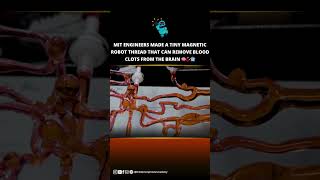 MIT's Tiny Magnetic Robot Could Change Brain Surgery Forever 🧠🤖✨