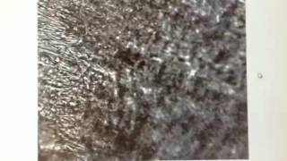 Beating Cardiac Patch