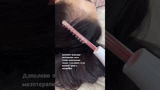 Дарсонваль . Выпадение волос . Мезотерапия кожи головы . Косметолог