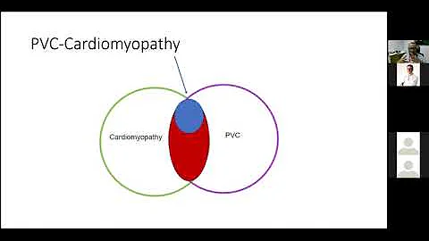 PVCs When Should We Worry