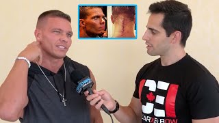 Tyson Kidd On His Career-Ending Neck Injury