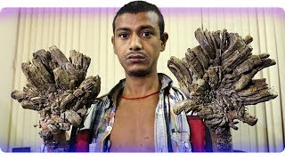 10 Самых Страшных Болезней Человека - Люди Со Страшными Болезнями 2017 — @cupeyeprod 10 Самых Страшных Болезней Человека - Люди Со Страшными Болезнями 2017 — @cupeyeprod
