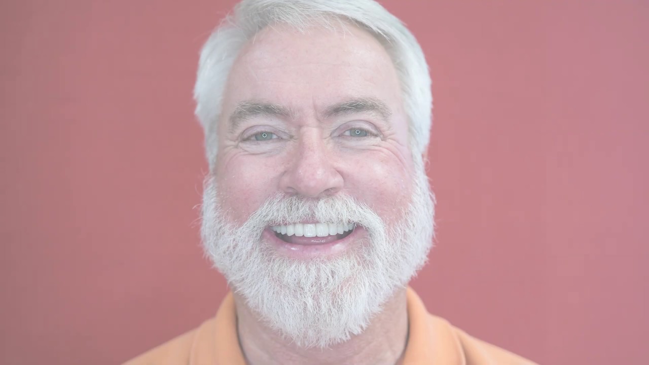 Rick's Time Lapse Smile Makeover with Porcelain Emax Crowns