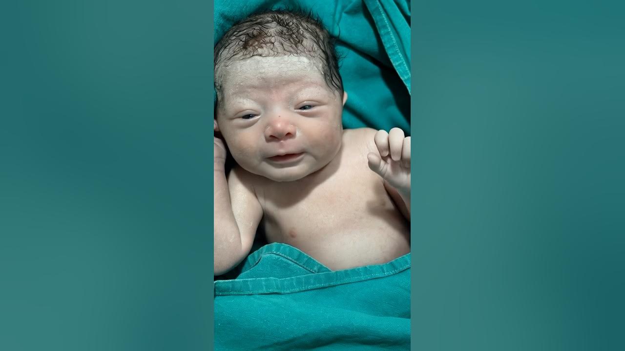 New born reaction after birth #adorably #newbornbaby #adoreble #baby #cute New born reaction after birth #adorably #newbornbaby #adoreble #baby #cute