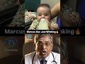 Marcus Gunn Jaw-Winking | Best app for NEET PG Preparation |Dopamine|