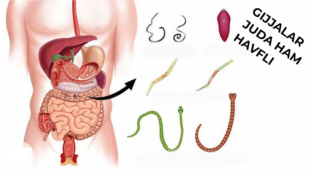 Какие паразиты обитают в организме. Червяки в организме человека.
