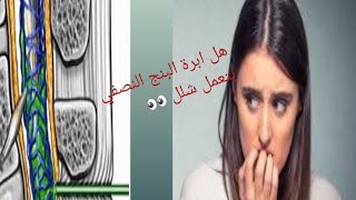 هل البنج النصفي ممكن يسبب شلل ؟؟