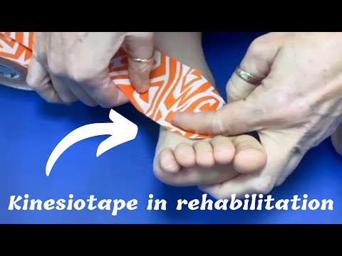 How to use Elastic KT tape in general. What are the KinesioTape benefits in our therapy?