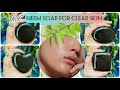 Diy homemade neem soap for clean bright and acne free glowing skin diy soap