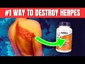 How to Destroy Herpes Fast and Naturally