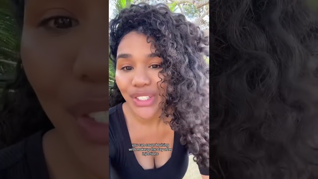 Do you bruise after Cosmetic injections?