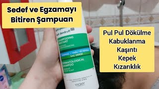 SAÇINDA Sedef , Egzama ve Kepek Olanlar DİKKAT❗️Kabuklanmaya İyi Gelen Şampuanı Saçınızda Deneyin👍 Resimi