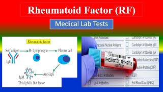 Rheumatoid Factor (RF) Test - Medical  Lab Tests -  What is  , Uses , Need , Preparation , Results