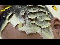 [DRY SCALP] Big Flakes Dandruff Scratching Satisfying Video #986
