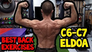 ELIMINATE NECK PAIN, Improve Your Posture, and Improve Your Spinal Health with the C6-C7 ELDOA