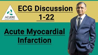 ECG Discussion 1-22 | Acute Myocardial Infarction | 2022