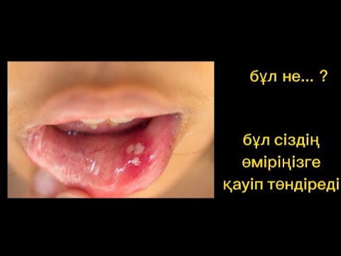 Video: Жыгылганда киндиги канабы?