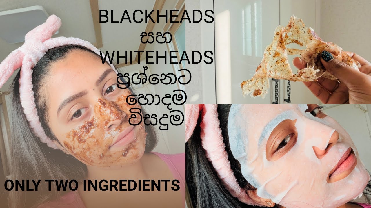 අමුද්‍රව්‍ය දෙකකින් මූණ ලස්සන කරගමු 🧖🏻‍♀️| අනවශ්‍ය රෝම, blackheads, whiteheads වලට විසදුම #skincare 
