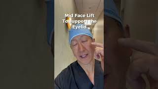 Upper & lower eyelid #blepharoplasty. We use a midface lift for support #eyelifts. #plasticsurgery