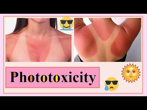 Video: Hoe fototoxiciteit te genezen?