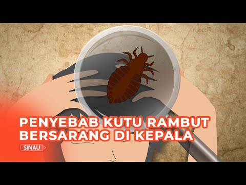 Penyebab Kutu Rambut Bersarang di Kepala, Jangan Diremehkan!