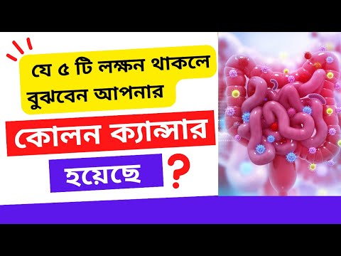 ভিডিও: কোলোন দেখার সেরা সময়