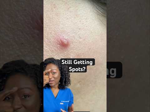 Still getting spots as an adult? Here’s why and what can help! @LaRochePosay #EFFACLARAZ #ad