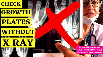 HOW TO CHECK GROWTH PLATES WITHOUT X RAY ? Height Growth After 18 ? Height Increase Tips (Hindi)