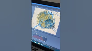 Mushroom spores magnified - Nature’s microscopic wonders #microscope #microbiology