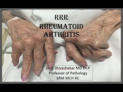 Vídeo: Artritis (sèptica) En Gats