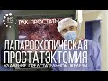 Лапароскопическая радикальная простатэктомия