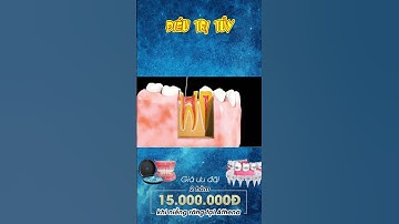 [3D] ĐIỀU TRỊ TỦY || Nha Khoa Quốc Tế Athena