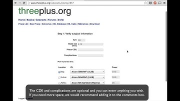 Postop data for SIA and IOL calculations