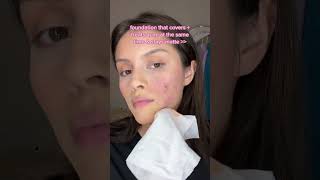 Cover Treat Acne with Foundation Skincare Makeup Hybrid