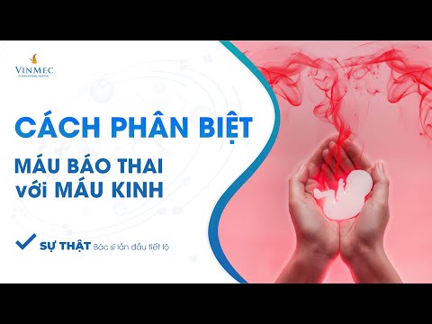 Video: 3 cách để biết sự khác biệt giữa kỳ kinh và sẩy thai