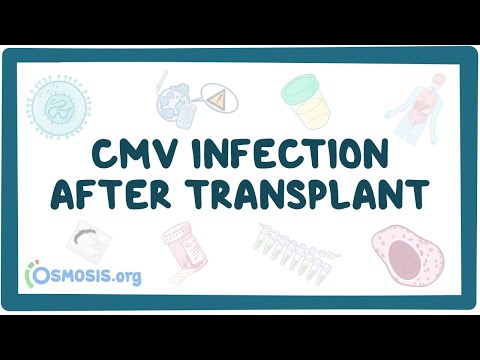 CMV infection after transplant