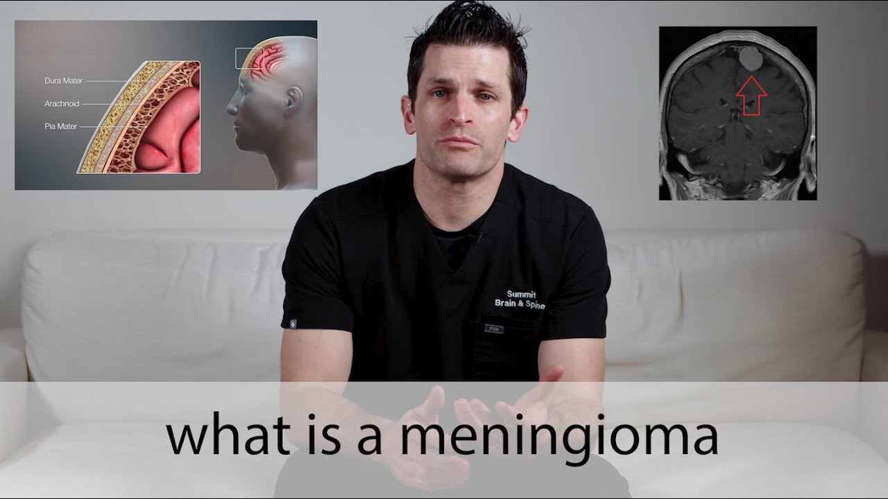 Meningiomas // everything you need to know