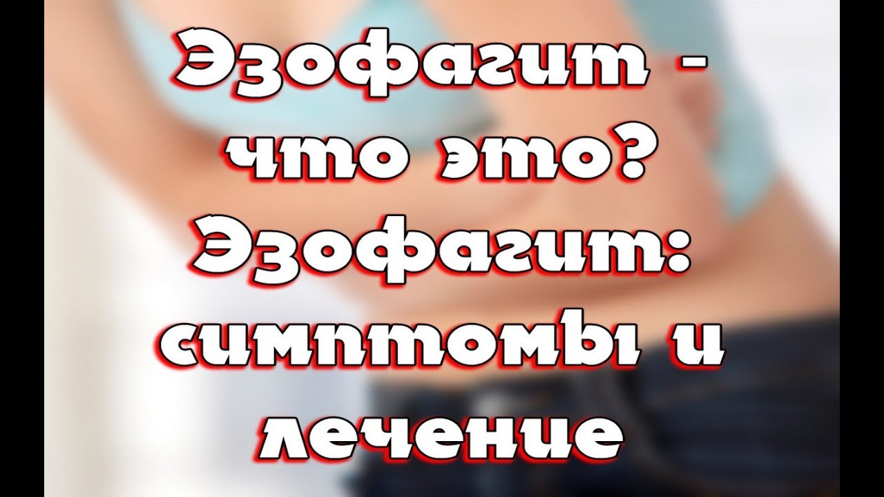 Рефлюкс-эзофагит: лечение народными средствами Рефлюкс-эзофагит: лечение народными средствами